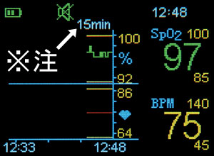 トレンド表示の画面です。